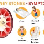 7 Kidney Stone Symptoms: Are You at Risk?