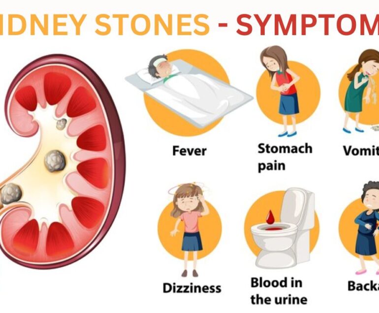 7 Kidney Stone Symptoms: Are You at Risk?