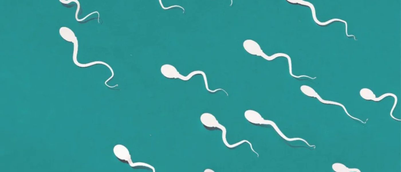 Next Steps After a Semen Analysis: What to Expect?